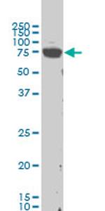 LIMK1 Antibody in Western Blot (WB)