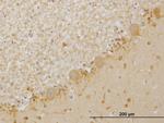 LIMK1 Antibody in Immunohistochemistry (Paraffin) (IHC (P))