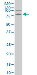 LIMK1 Antibody in Western Blot (WB)