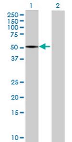 FADS1 Antibody in Western Blot (WB)