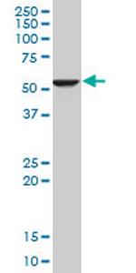 FADS1 Antibody in Western Blot (WB)