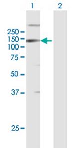 LLGL2 Antibody in Western Blot (WB)