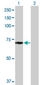 LPL Antibody in Western Blot (WB)