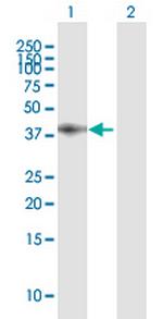 LRP1 Antibody in Western Blot (WB)