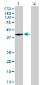 LRP1 Antibody in Western Blot (WB)