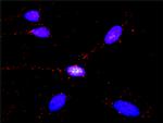 SMAD1 Antibody in Proximity Ligation Assay (PLA) (PLA)