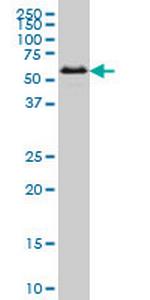 SMAD1 Antibody in Western Blot (WB)