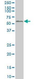 SMAD2 Antibody in Western Blot (WB)