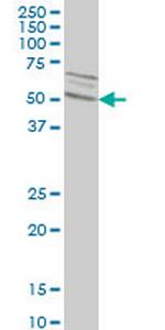 SMAD2 Antibody in Western Blot (WB)