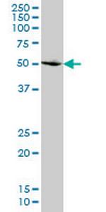 SMAD2 Antibody in Western Blot (WB)