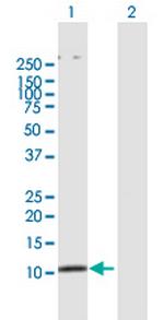 SMAD3 Antibody in Western Blot (WB)