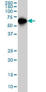 SMAD4 Antibody in Western Blot (WB)