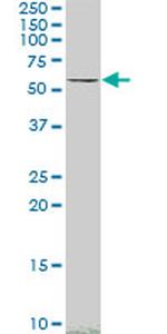 SMAD4 Antibody in Western Blot (WB)