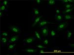 SMAD5 Antibody in Immunocytochemistry (ICC/IF)