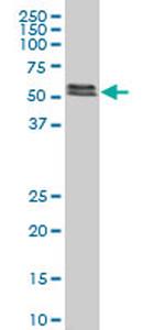 SMAD5 Antibody in Western Blot (WB)