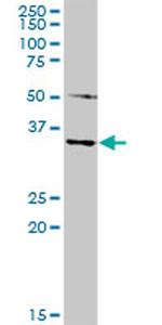 MAGEA4 Antibody in Western Blot (WB)