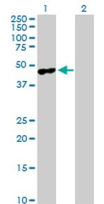 MAGEA4 Antibody in Western Blot (WB)