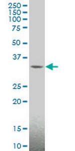 MAGEA4 Antibody in Western Blot (WB)