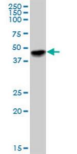 MAGEA12 Antibody in Western Blot (WB)