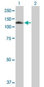 MANBA Antibody in Western Blot (WB)