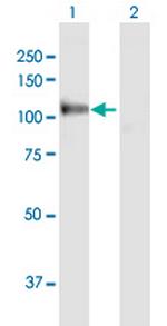 MANBA Antibody in Western Blot (WB)