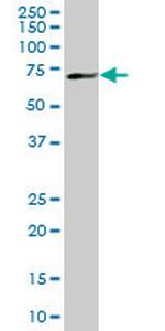 MBD1 Antibody in Western Blot (WB)