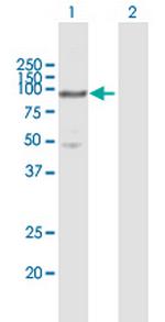 MCM5 Antibody in Western Blot (WB)