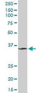 MDH1 Antibody in Western Blot (WB)