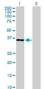 MDH1 Antibody in Western Blot (WB)