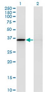 MDH1 Antibody in Western Blot (WB)