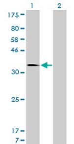 MDM2 Antibody in Western Blot (WB)