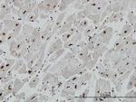 MECP2 Antibody in Immunohistochemistry (Paraffin) (IHC (P))