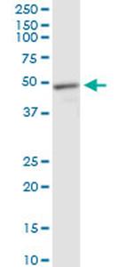 MECP2 Antibody in Western Blot (WB)