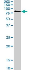 MECP2 Antibody in Western Blot (WB)