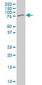 MECP2 Antibody in Western Blot (WB)