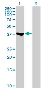 MEF2B Antibody in Western Blot (WB)