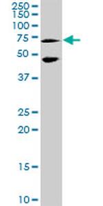 MEF2C Antibody in Western Blot (WB)