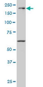 MAP3K4 Antibody in Western Blot (WB)