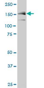 MAP3K5 Antibody in Western Blot (WB)