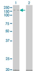 MAP3K5 Antibody in Western Blot (WB)