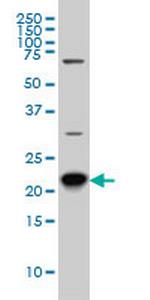 RAB8A Antibody in Western Blot (WB)