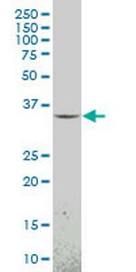 MEOX1 Antibody in Western Blot (WB)