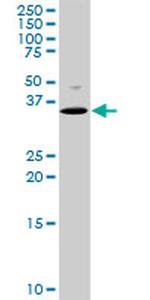 MEOX2 Antibody in Western Blot (WB)