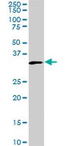 MEOX2 Antibody in Western Blot (WB)