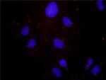 MET Antibody in Proximity Ligation Assay (PLA) (PLA)