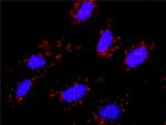 MET Antibody in Proximity Ligation Assay (PLA) (PLA)