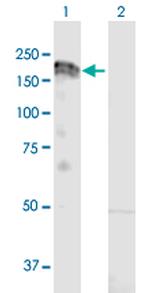 MET Antibody in Western Blot (WB)