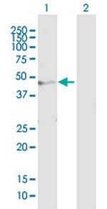 MGAT1 Antibody in Western Blot (WB)