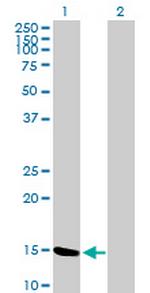 MGST2 Antibody in Western Blot (WB)