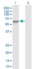 MMP3 Antibody in Western Blot (WB)